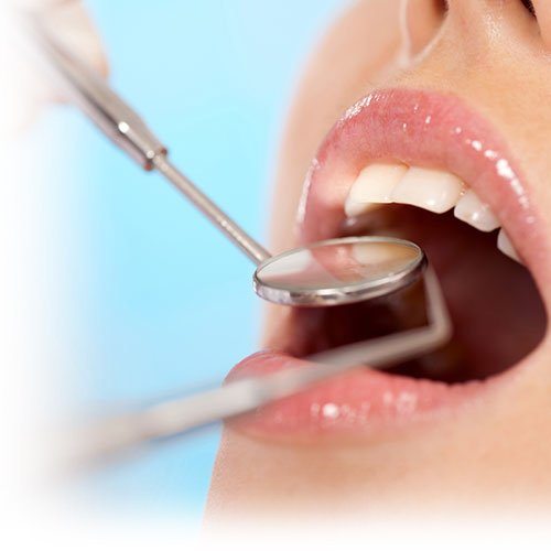 Dental check-up and cleaning